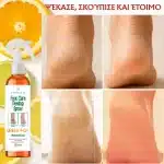 Απολεπιστικό σπρέι απολέπισης ποδιών, peeling, εκχύλισμα πορτοκαλιού, βαθύς καθαρισμός και βαθιά φροντίδα, Verilaria, 250ml - Image 2