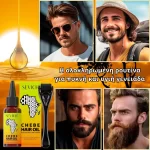 Σετ για την ανάπτυξη της γενειάδας – Derma Roller και λάδι Chebe, βιοτίνη, πυκνή και υγιής γενειάδα, Sevich - Image 2