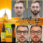 Σετ για την ανάπτυξη της γενειάδας – Derma Roller και λάδι Chebe, βιοτίνη, πυκνή και υγιής γενειάδα, Sevich - Image 4