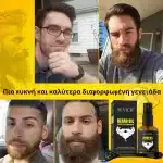 Σετ για την ανάπτυξη της γενειάδας – derma roller, βιοτίνη, δενδρολίβανο, φυσική τόνωση και θρέψη, Sevich - Image 5