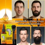 Σετ για την ανάπτυξη της γενειάδας – Derma Roller και λάδι Chebe, βιοτίνη, πυκνή και υγιής γενειάδα, Sevich - Image 6