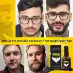 Σετ για την ανάπτυξη της γενειάδας – derma roller, βιοτίνη, δενδρολίβανο, φυσική τόνωση και θρέψη, Sevich - Image 6